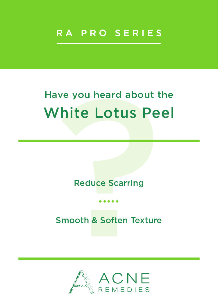 Product view
